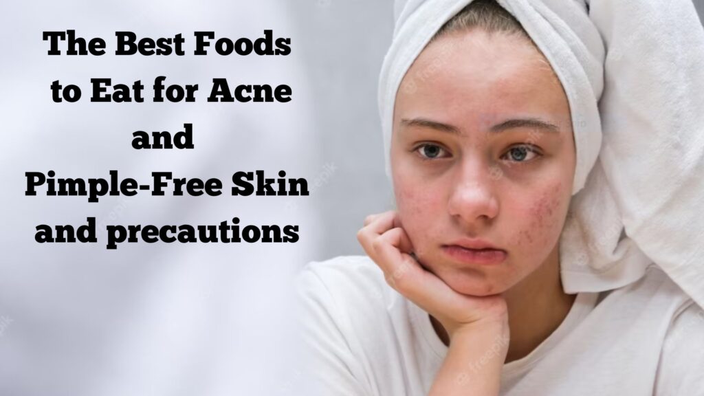 The Best Foods To Eat For Acne And Pimple Free Skin And Precautions 