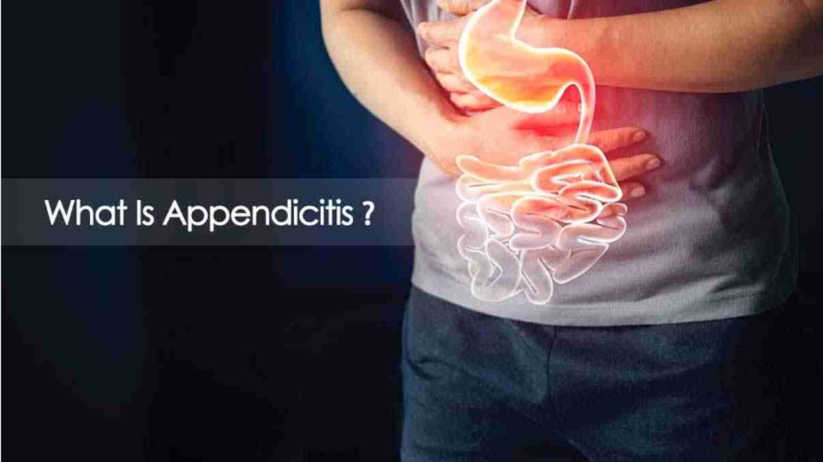 Appendicitis 101 Understanding The Causes And Symptoms ଆଜିକାଲି